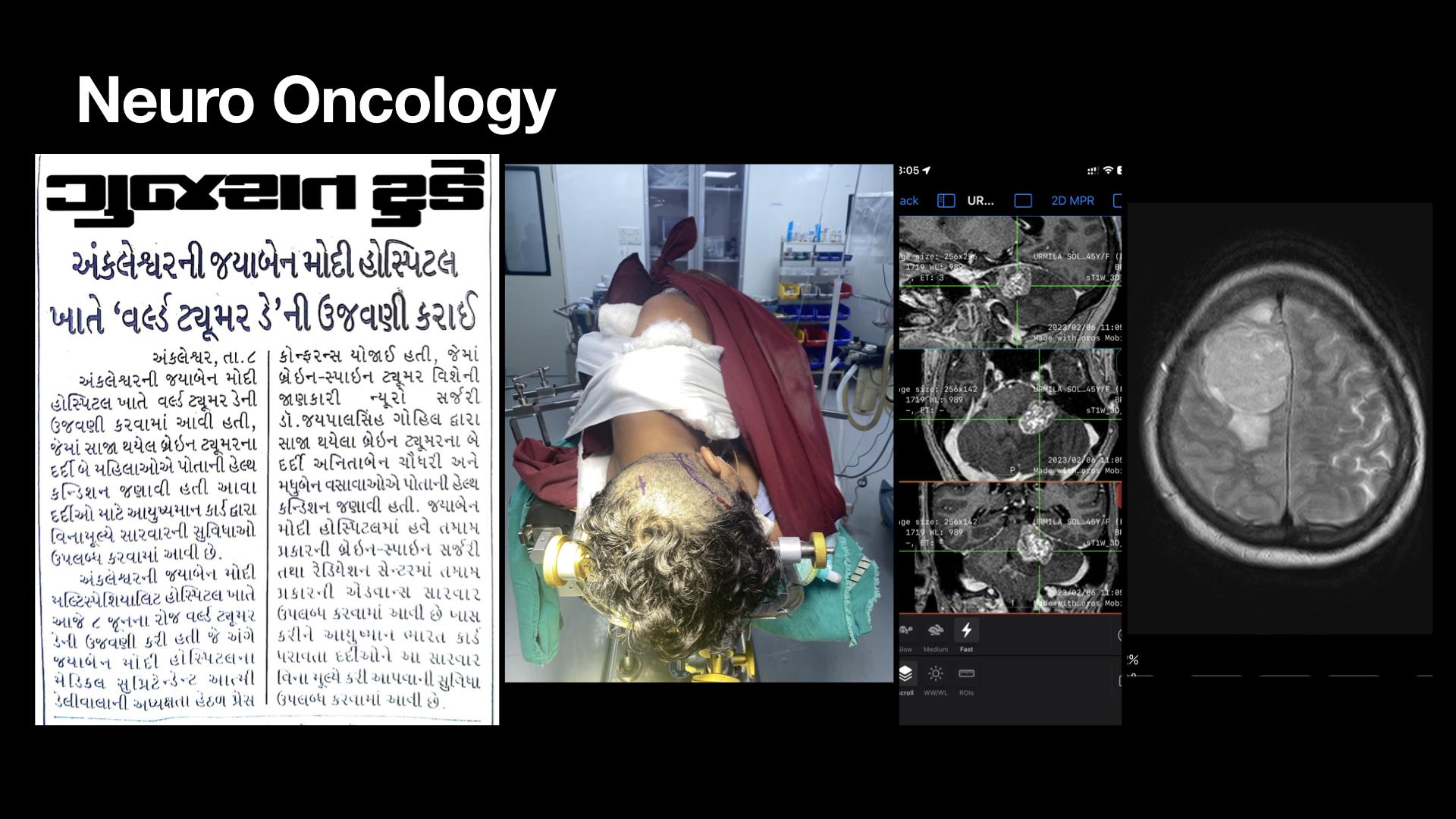 Neurosurgical Care in Ankleshwar
                                